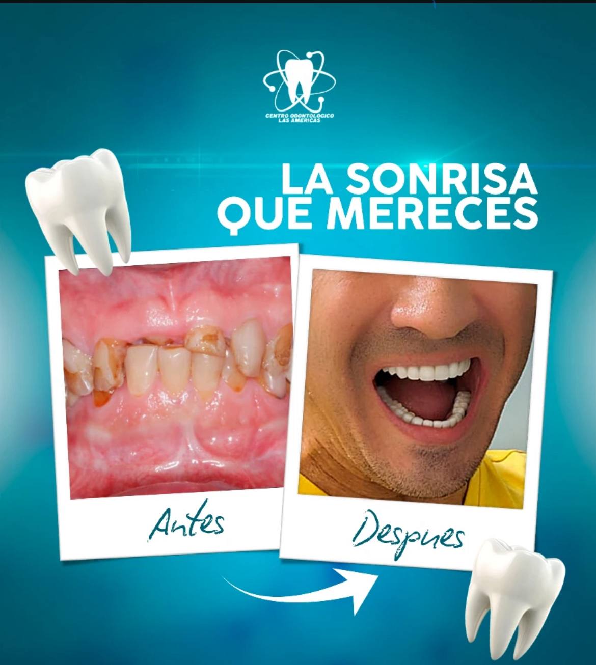 Transformación dental - La Sonrisa Que Mereces